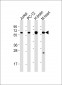 CAMK2 beta Antibody (C-term)