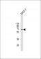 MDM2 Antibody