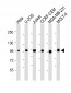 RANBP9 Antibody