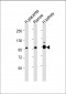 MME Antibody (Center)