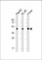 ADK Antibody (N-term)