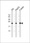 AK1 Antibody (C-term)