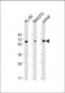 ME2 Antibody (C-term)