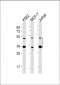 MBD2 Antibody