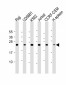 CTLA4 Antibody (N-term)