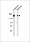 CFH Antibody (Center)