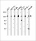 MYO6 Antibody (C-term R1181)
