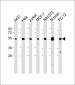 TUBA4A Antibody (C-term)