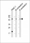 SLC11A2 Antibody (Center)