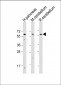 SLC11A2 Antibody (Center)