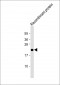 Erythropoietin Antibody (N-term)