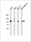 HUMAN-CTNND1_isform 2ABC(Y174) Antibody