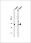 Mouse Nkx2-5 Antibody (Center)