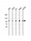 EEF2K (Ser366) Antibody