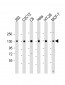 MYPT1 (Thr696) Antibody