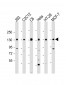 MYPT1 (Thr852) Antibody