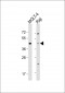 CD24 Antibody (Center)