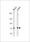 Syk(Y525/526) Antibody