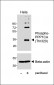Phospho-PPP1CA (Thr320) Antibody