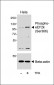 Phospho-eEF2k (Ser366) Antibody