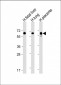 PPARG Antibody (N-term)