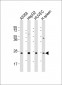 CD151 Antibody (Center)