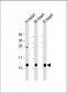 PLB-T17 Antibody