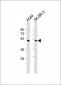 INHBB Antibody (C-term)