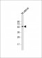 INHBB Antibody (C-term)