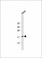 p16INK4a Antibody (C-term E119)