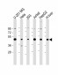 SLC39A14 Antibody (N-term)