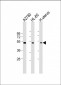 BMP15 Antibody (Center)