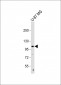 THBS4 Antibody(C-term)