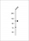 PKN1 Antibody (C-Term)