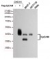 Anti-EpCAM Antibody