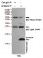 Anti-S100A4 Antibody