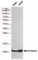 Anti-S100A4 Antibody