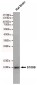 Anti-S100B Antibody