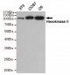 Anti-Hexokinase II Antibody