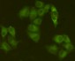 Anti-Jak1 Antibody