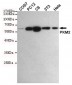 Anti-PKM2 Antibody