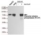 Anti-Placental alkaline phosphatase (PLAP) Antibody