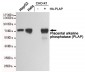 Anti-Placental alkaline phosphatase (PLAP) Antibody