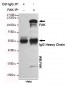 Anti-FAK Antibody