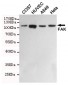 Anti-FAK Antibody