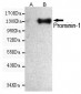 Anti-CD133 Monoclonal Antibody