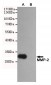 Anti-MMP-2 Antibody
