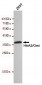 Anti-HTRA2 Antibody