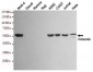 Anti-Vimentin Antibody