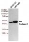 Anti-Enolase-2 Antibody